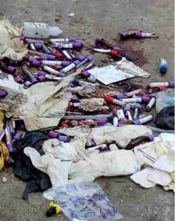 See The Way Gbagada General Hospital, Lagos, Liters The Road With Patients’ Blood Samples